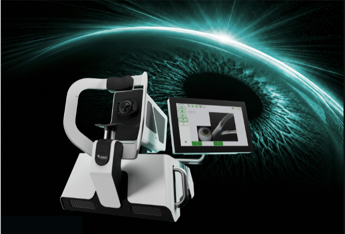 ASTRAL®: The First Non-contact SLT Platform featuring OCT Visualization systemfor Precision Glaucoma Treatment
